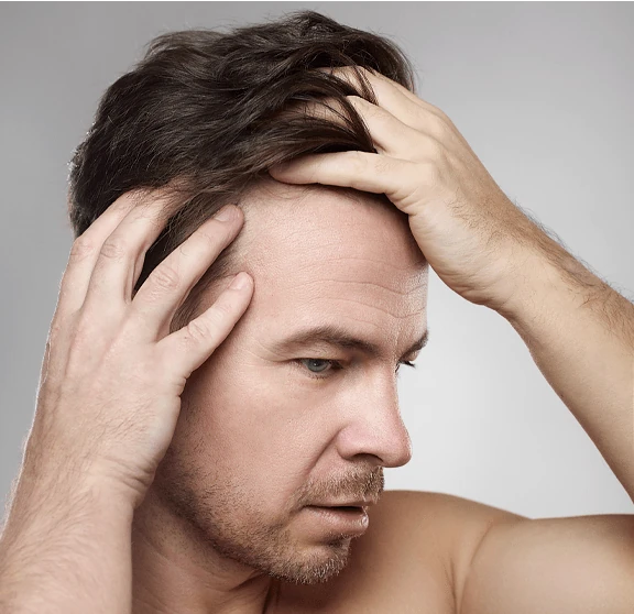 Homme aux cheveux denses grâce à Folicerin