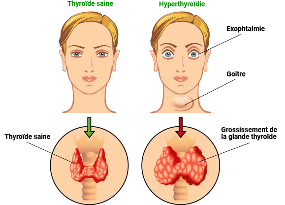 Illustration de la glande thyroïde, cœur de notre vitalité et métabolisme